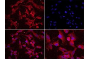 U251 cells probed with Rabbit Anti-MAP2(Ser136) Polyclonal Antibody used at 1:200 dilution for 40 minutes at 37°C. (MAP2 Antikörper  (pSer136))
