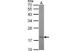 TIMM17A 抗体  (C-Term)