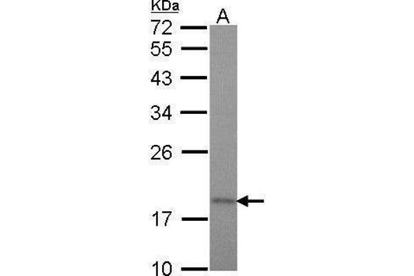 TIMM17A Antikörper  (C-Term)