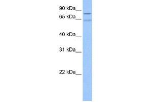 WB Suggested Anti-ZNF724P Antibody Titration:  0. (ZNF724P Antikörper  (N-Term))