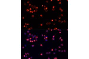 Immunofluorescence analysis of HeLa cells using  antibody (ABIN3020944, ABIN3020945, ABIN3020946 and ABIN6213811) at dilution of 1:100. (AKT2 Antikörper)