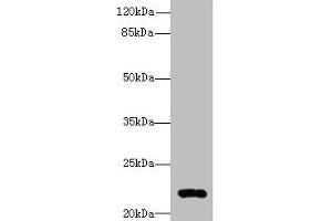 Western blot All lanes: ARL14 antibody at 0. (ARL14 Antikörper  (AA 2-192))