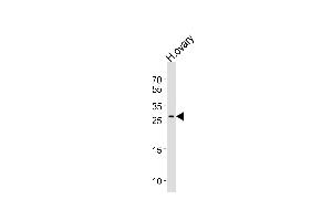 Western blot analysis of lysate from human ovary tissue lysate, using LRRN4CL Antibody (Center) (ABIN656629 and ABIN2845875). (LRRN4CL Antikörper  (AA 117-146))