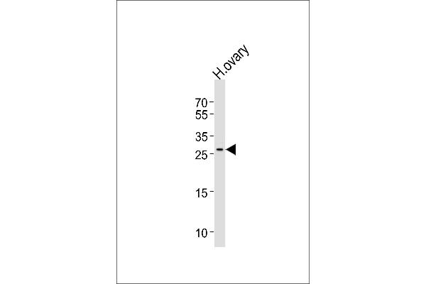 LRRN4CL Antikörper  (AA 117-146)