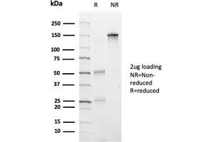 SDS-PAGE Analysis Purified HDAC6 Mouse Monoclonal Antibody (PCRP-HDAC6-1A4). (HDAC6 Antikörper)