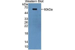 Western blot analysis of the recombinant protein. (EPH Receptor A4 Antikörper  (AA 621-882))