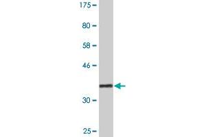 Western Blot detection against Immunogen (36. (RSU1 Antikörper  (AA 178-277))