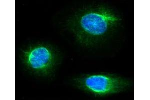 ICC/IF analysis of FKBP4 in HeLa cells line, stained with DAPI (Blue) for nucleus staining and monoclonal anti-human FKBP4 antibody (1:100) with goat anti-mouse IgG-Alexa fluor 488 conjugate (Green).