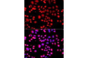 Immunofluorescence (IF) image for anti-Alveolar Soft Part Sarcoma Chromosome Region, Candidate 1 (ASPSCR1) (AA 284-553) antibody (ABIN6137219)