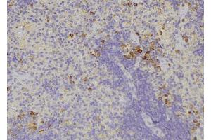 ABIN6278482 at 1/100 staining Human lymph node tissue by IHC-P. (IL32 Antikörper)