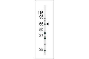 The anti-Phospho-SD3- Pab (ABIN389657 and ABIN2839640) is used in Western blot to detect Phospho-SD3- in Ramos tissue lysate (SMAD3 Antikörper  (pSer213))