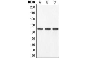 Western blot analysis of YAP1 expression in SW480 (A), HeLa (B), Caco2 (C) whole cell lysates. (YAP1 Antikörper  (Center))