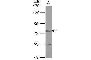 LRRN2 antibody