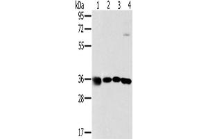 Western Blotting (WB) image for anti-Mitochondrial Ribosomal Protein L39 (MRPL39) antibody (ABIN2423812) (MRPL39 Antikörper)