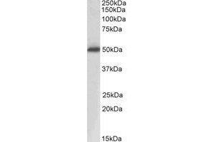 AP20162PU-N ACPP Antibody staining of Human Prostate lysate at 0. (ACPP Antikörper  (Internal Region))