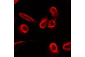 Immunofluorescent analysis of SLC22A11 staining in A549 cells. (SLC22A11 Antikörper)