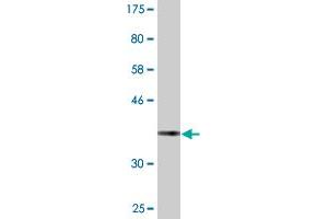 Western Blot detection against Immunogen (36. (NADAP Antikörper  (AA 154-254))