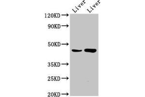 Western Blot Positive WB detected in: Rat liver tissue, Mouse liver tissue All lanes: CHKB antibody at 6. (CHKB Antikörper  (AA 2-99))