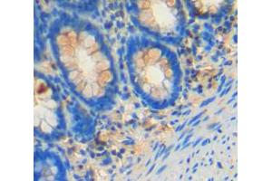 IHC-P analysis of rectum tissue, with DAB staining. (FES Antikörper  (AA 509-766))