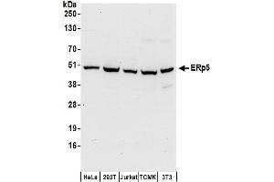 Western Blotting (WB) image for anti-Protein Disulfide Isomerase Family A, Member 6 (PDIA6) (AA 250-300) antibody (ABIN7453940)