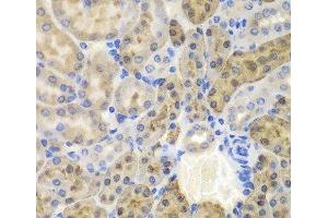 Immunohistochemistry of paraffin-embedded Mouse kidney using AKR1A1 Polyclonal Antibody at dilution of 1:100 (40x lens). (AKR1A1 Antikörper)