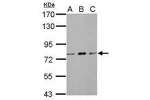 Image no. 3 for anti-Zinc Finger and BTB Domain Containing 20 (ZBTB20) (AA 1-668) antibody (ABIN1501916) (ZBTB20 Antikörper  (AA 1-668))