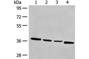 Western blot analysis of Human breast cancer tissue TM4 231 and Jurkat cell lysates using OTUD6A Polyclonal Antibody at dilution of 1:550 (OTUD6A Antikörper)