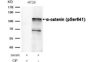 Western blot analysis of extracts from HT29 cells, treated with serum or calf intestinal phosphatase (CIP), using α-catenin (Phospho-Ser641) Antibody. (CTNNA1 Antikörper  (pSer641))