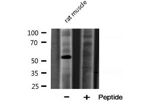 Western blot analysis of ARSA expression in Rat muscle lysate (Arylsulfatase A Antikörper  (Internal Region))