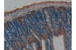 DAB staining on IHC-P; Samples: Rat Intestine Tissue
