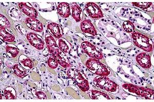 Human Kidney, Tubules: Formalin-Fixed, Paraffin-Embedded (FFPE) (DHX9 Antikörper  (AA 1-91))