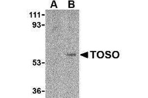Western Blotting (WB) image for anti-Fas Apoptotic Inhibitory Molecule 3 (FAIM3) (C-Term) antibody (ABIN2476897) (FAIM3 Antikörper  (C-Term))
