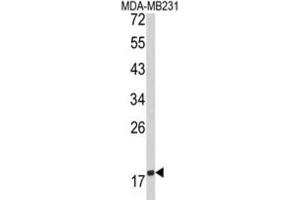 Western Blotting (WB) image for anti-CD28 (CD28) antibody (ABIN5022870) (CD28 Antikörper)
