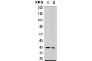 Western blot analysis of CALHM1 expression in human brain (A), rat brain (B) whole cell lysates.