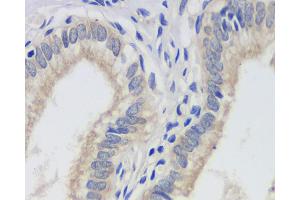 Immunohistochemistry analysis of paraffin-embedded human gallbladder using FAS Monoclonal Antibody at dilution of 1:200. (FAS Antikörper)