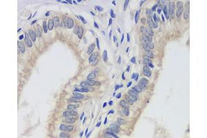 Immunohistochemistry analysis of paraffin-embedded human gallbladder using FAS Monoclonal Antibody at dilution of 1:200.