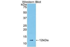 Western blot analysis of the recombinant protein. (CCL5 Antikörper  (AA 24-91))