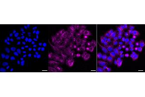 anti-gamma-aminobutyric Acid (GABA) A Receptor, alpha 5 (GABRA5) antibody