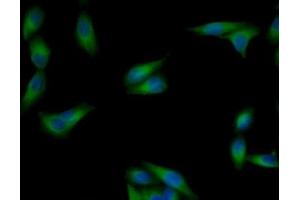 Detection of TUBb in Human MCF7 Cells using Monoclonal Antibody to Tubulin Beta (TUBb) (TUBB Antikörper  (AA 170-419))