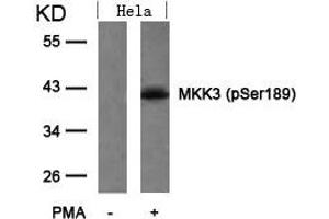 Western blot analysis of extracts from Hela cells untreated or treated with PMA using MKK3(Phospho-Ser189) Antibody. (MAP2K3 Antikörper  (pSer189))