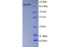 SDS-PAGE (SDS) image for Desmoglein 3 (DSG3) (AA 50-615) protein (His-SUMO Tag) (ABIN5709421) (Desmoglein 3 Protein (DSG3) (AA 50-615) (His-SUMO Tag))