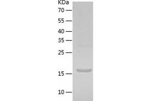 Western Blotting (WB) image for RAN Binding Protein 1 (RANBP1) (AA 1-201) protein (His tag) (ABIN7124773) (RANBP1 Protein (AA 1-201) (His tag))