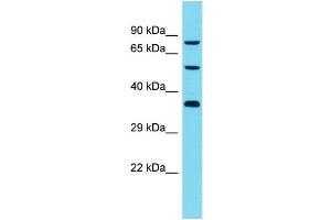 Host: Rabbit Target Name: DCAF8L2 Sample Type: Jurkat Whole Cell lysates Antibody Dilution: 1. (DCAF8L2 Antikörper  (C-Term))