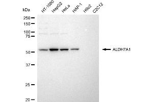 Western blotting analysis using ALDH7A1 antibody (ABIN7797567).