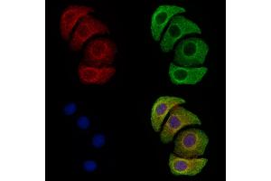 ABIN6255764 and ABIN6274056 staining Hela cells(4h of LPS treatment) by IF/ICC.