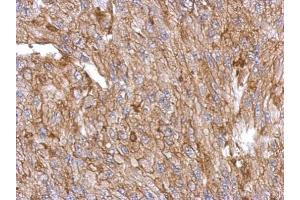 IHC-P Image Immunohistochemical analysis of paraffin-embedded U87 xenograft, using Annexin III, antibody at 1:500 dilution. (Annexin A3 Antikörper)