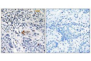 Immunohistochemistry (IHC) image for anti-Zinc Finger and BTB Domain Containing 40 (ZBTB40) (C-Term) antibody (ABIN1852400) (ZBTB40 Antikörper  (C-Term))