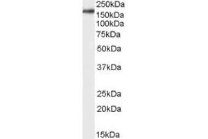 Western Blotting (WB) image for anti-CCR4-NOT Transcription Complex, Subunit 6-Like (CNOT6L) (Middle Region) antibody (ABIN2790464)