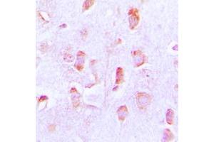 Immunohistochemical analysis of BCL2 staining in human brain formalin fixed paraffin embedded tissue section. (Bcl-2 Antikörper  (Center))
