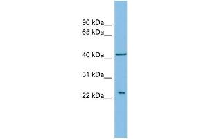 WB Suggested Anti-RALB Antibody Titration: 0.